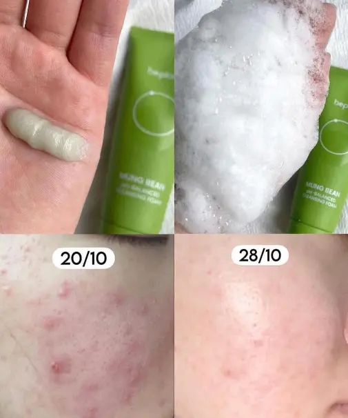 OliveYoung連線 | BePlain 綠豆弱酸洗面奶套裝 160mL+40mL 160ml+160ml